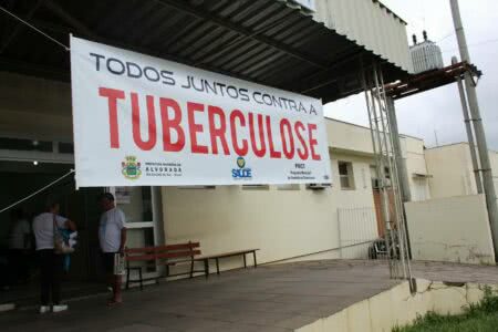 Tuberculose: uma epidemia silenciosa e invisível (por Elsa Roso e Nilson Lopes)
