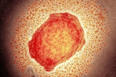 Brasileiro tem 1º caso de varíola dos macacos registrado na Alemanha