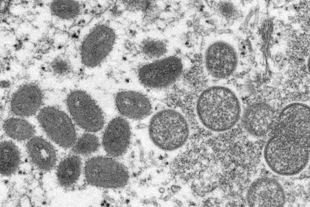 Varíola do macaco é uma doença viral endêmica no continente africano. Imagem: Reprodução/SES