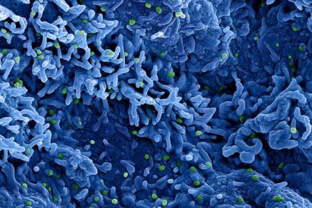 Micrografia eletrônica de transmissão colorida de partículas de varíola de macaco  encontradas dentro de uma célula infectada , cultivadas em laboratório. Foto: NIAID/Fotos Públicas
