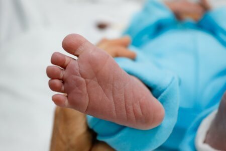 RS é o 6º estado com maior número de bebês hospitalizados por desnutrição