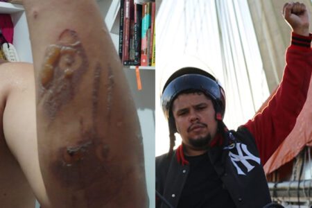 Entregador antifascista 'Galo' denuncia tortura que sofreu por parte da PM de São Paulo/SP. Foto: Arquivo pessoal e Scarlet Rocha
